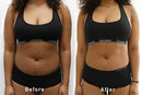 Vacuactivus Iceberg Cryonick Roller Mini- Body Shaper